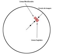 sagitales-meridionales-MTF